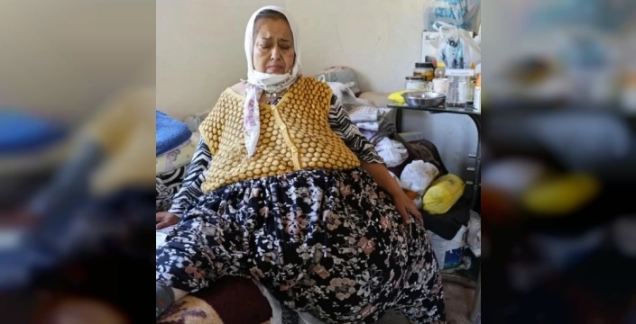 Hayatını karartan dev kitle: 170 kiloya ulaşan kadının karnından 40 kilo çıktı